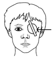 eye-patch-over-good-eye